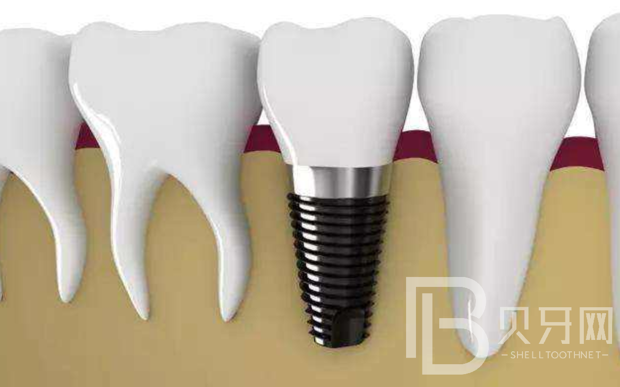 1645780389172824.png 000.png