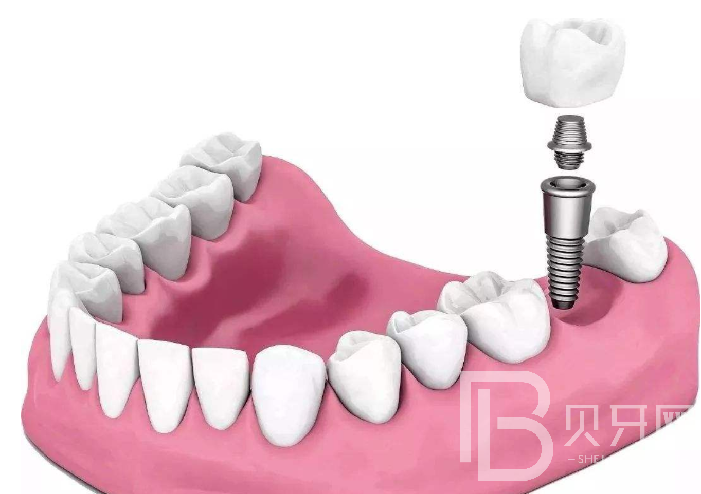 1645857852697717.png 999.png