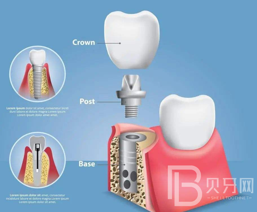 1645861973154925.png 000.png