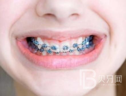 广州团圆口腔怎么样？广州团圆口腔种植牙一颗多少钱