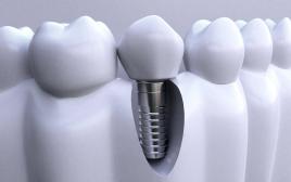 牙齿缺失怎么修复比较好？北京中诺口腔医院牙齿修复怎么样？