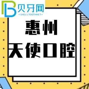 惠州天使口腔门诊怎么样？市民说活动价格不贵。